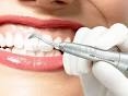 Ультразвуковая чистка зубов в Боре